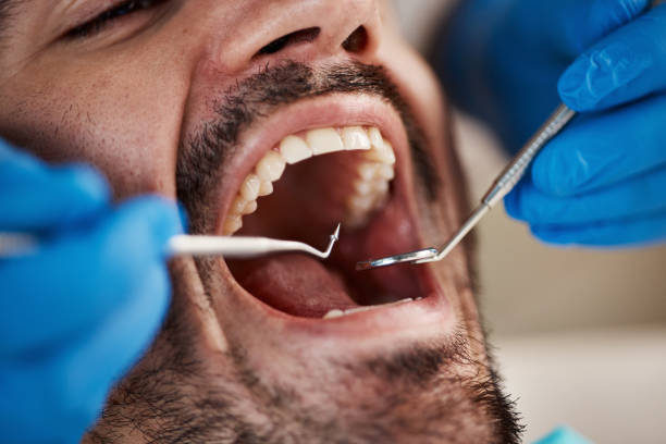 Best Emergency Dental Services for Seniors in Pataskala, OH